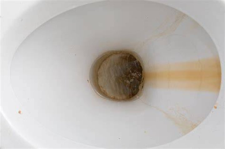 Why does well water stain toilet?