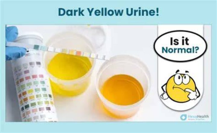 Why is my urine yellow in the morning?