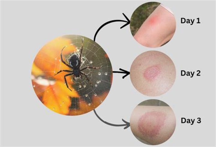 Will a huntsman spider bite me?