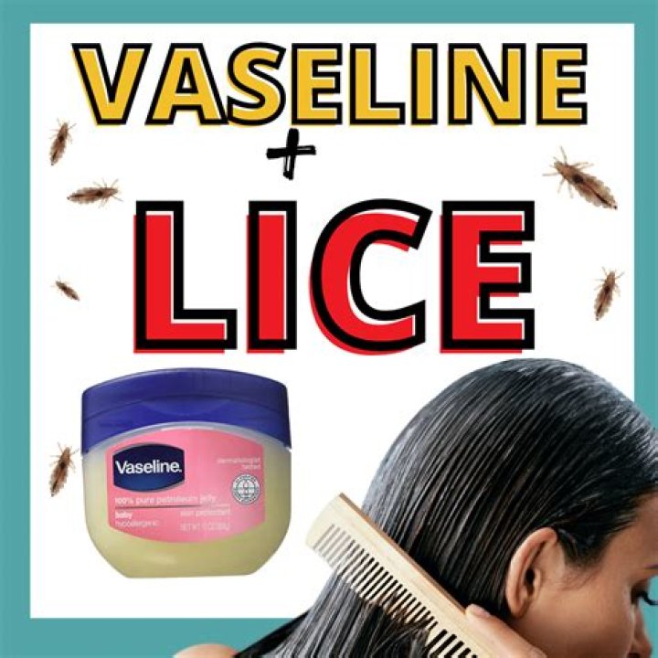 Will Vaseline kill head lice?